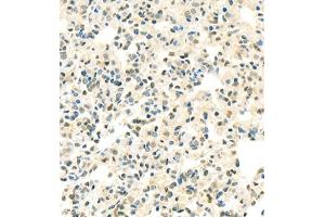 Immunohistochemistry of paraffin embedded rat lung using Thymosin (ABIN7075306) at dilution of 1:1500 (400x lens) (PTMA 抗体)