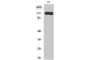 Western Blotting (WB) image for anti-Hairless (HR) (N-Term) antibody (ABIN3175456) (Hairless 抗体  (N-Term))