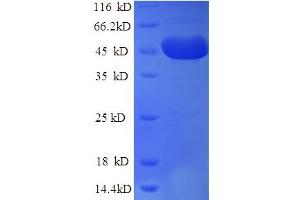 SDS-PAGE (SDS) image for DCP2 Decapping Enzyme Homolog (DCP2) (AA 1-385), (Isoform 2) protein (His tag) (ABIN5711505)