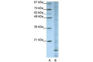 WB Suggested Anti-FAM121B Antibody Titration:  1. (APOO 抗体  (N-Term))