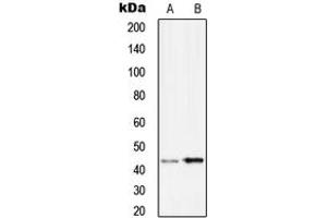 Western blot analysis of Serpin B9 expression in Ramos (A), HuvEc (B) whole cell lysates. (SERPINB9 抗体  (Center))