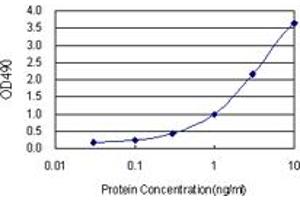 E4F1 (Human) Matched Antibody Pair
