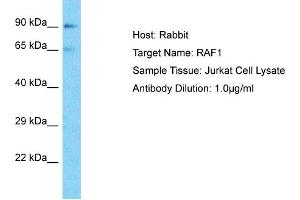 Host: Rabbit Target Name: RAF1 Sample Type: Jurkat Whole Cell lysates Antibody Dilution: 1. (RAF1 抗体  (Middle Region))