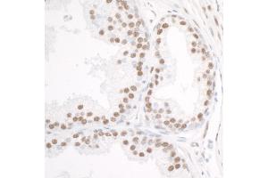 Immunohistochemistry (IHC) image for anti-DEAD (Asp-Glu-Ala-Asp) Box Polypeptide 5 (DDX5) (C-Term) antibody (ABIN7454642) (DDX5 抗体  (C-Term))