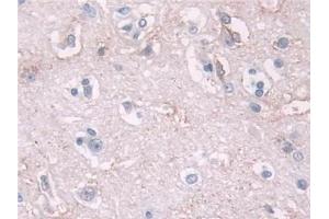 Detection of NELL2 in Human Cerebrum Tissue using Polyclonal Antibody to NEL Like Protein 2 (NELL2) (NELL2 抗体  (AA 64-331))