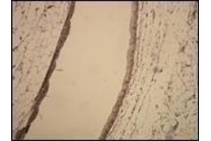 Immunohistochemistry (IHC) image for anti-Actin (C-Term) antibody (ABIN870291) (Actin 抗体  (C-Term))