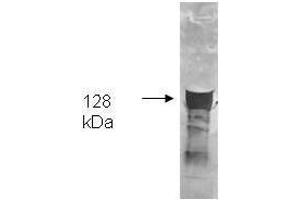 Both the antiserum and IgG fractions of anti-Glycerol Kinase (Cellulomonas) are shown to detect the 128,000 dalton enzyme in cellular extracts. (Glycerol Kinase 抗体)
