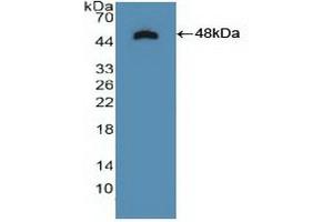 Detection of Recombinant NTRK2, Human using Polyclonal Antibody to Tropomyosin Receptor Kinase B (TrkB) (Tropomyosin Receptor Kinase B (AA 32-430) 抗体)