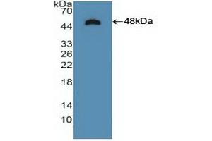 Western Blotting (WB) image for anti-Neurotrophic Tyrosine Kinase, Receptor, Type 2 (NTRK2) (AA 32-430) antibody (ABIN7443689)