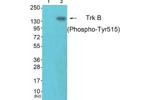 Western blot analysis of extracts from NIH/3T3 cells, using Trk B (phospho-Tyr515) antibody. (TRKB 抗体  (pTyr515))