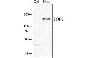 Image no. 1 for anti-DNA Topoisomerase II (TOP2) (C-Term), (N-Term) antibody (ABIN334538) (TOP2 抗体  (C-Term, N-Term))