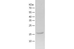 Western Blotting (WB) image for CCHC-Type Zinc Finger, Nucleic Acid Binding Protein (CNBP) (AA 1-170) protein (His tag) (ABIN7122189) (CNBP Protein (AA 1-170) (His tag))