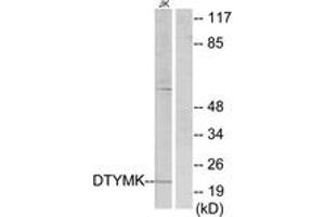 Western blot analysis of extracts from Jurkat cells, using DTYMK Antibody. (DTYMK 抗体  (AA 1-50))
