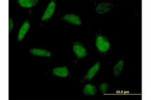 Immunofluorescence of purified MaxPab antibody to ING1 on HeLa cell. (ING1 抗体  (AA 1-279))