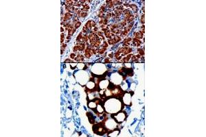 PDHX polyclonal antibody  staining of paraffin embedded human pancreas. (PDHX 抗体)