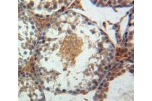 Used in DAB staining on fromalin fixed paraffin-embedded Testis tissue (Paxillin 抗体  (AA 347-578))