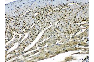 IHC analysis of Laminin using anti-Laminin antibody . (Laminin gamma 1 抗体  (all Isoforms))