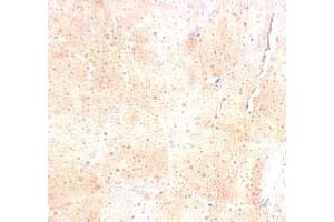 Immunohistochemical staining of mouse skeletal muscle cells with SYNPO2 polyclonal antibody  at 5 ug/mL. (SYNPO2 抗体  (N-Term))