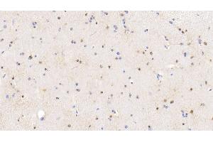 Detection of S100 in Bovine Cerebrum Tissue using Polyclonal Antibody to S100 Calcium Binding Protein (S100) (S100 Protein (S100) (AA 1-94) 抗体)