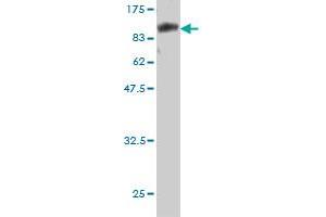 Western Blotting (WB) image for anti-Calcium/calmodulin-Dependent Protein Kinase Kinase 1, alpha (CAMKK1) (AA 1-520) antibody (ABIN566554)