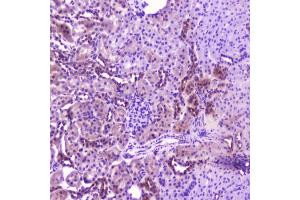 IHC testing of FFPE rat kidney with IL36A antibody at 2ug/ml. (IL36A/IL1F6 抗体  (AA 6-151))