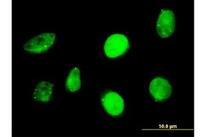 Immunofluorescence of monoclonal antibody to SP110 on HeLa cell. (SP110 抗体  (AA 271-380))