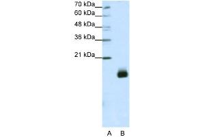 WB Suggested Anti-RPS14 Antibody Titration:  1.