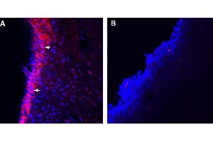 Expression of TRPA1 in mouse brainstem.