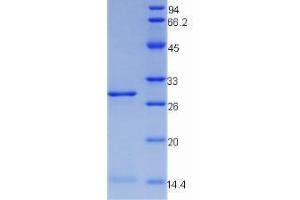 SDS-PAGE analysis of Mouse Transferrin Receptor Protein. (Transferrin Receptor 蛋白)