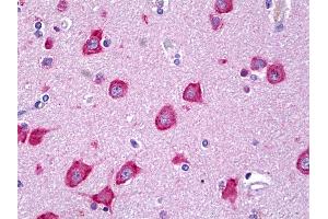 Anti-MLKL antibody IHC of human brain, cortex neurons. (MLKL 抗体  (AA 371-472))