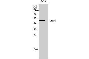Western Blotting (WB) image for anti-C-terminal Binding Protein 2 (CTBP2) (C-Term) antibody (ABIN3174596) (CTBP2 抗体  (C-Term))