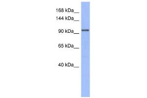 WB Suggested Anti-MSH4 Antibody Titration:  0. (MSH4 抗体  (N-Term))