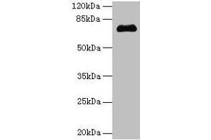 Western blot All lanes: PMEL antibody at 14 μg/mL + Jurkat whole cell lysate Secondary Goat polyclonal to rabbit IgG at 1/10000 dilution Predicted band size: 71, 61, 67 kDa Observed band size: 71 kDa (Melanoma gp100 抗体  (AA 25-467))