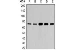 Western blot analysis of PAIP1 expression in HepG2 (A), A549 (B), mouse liver (C), mouse kidney (D), rat brain (E) whole cell lysates. (PAIP1 抗体)