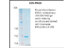 SDS-PAGE (SDS) image for Fibroblast Growth Factor 21 (FGF21) (Active) protein (ABIN5509462) (FGF21 蛋白)