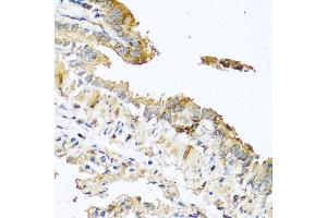 Immunohistochemistry of paraffin-embedded mouse lung using RNASE11 antibody at dilution of 1:100 (40x lens). (RNASE11 抗体)