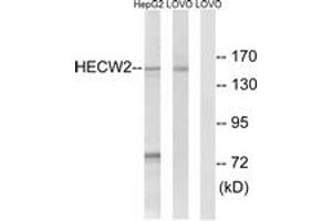 Western blot analysis of extracts from LOVO/HepG2 cells, using HECW2 Antibody.