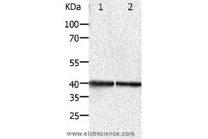 Western blot analysis of Hela and Jurkat cell, using PDX1 Polyclonal Antibody at dilution of 1:450 (PDX1 抗体)