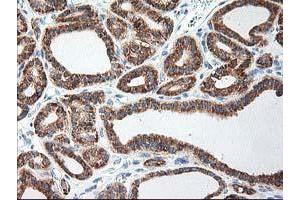 Image no. 1 for anti-Ribophorin 1 (RPN1) antibody (ABIN1500749) (RPN1 抗体)