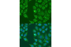Immunofluorescence analysis of U2OS cells using HSD17B3 antibody (ABIN2736919) at dilution of 1:100. (HSD17B3 抗体)
