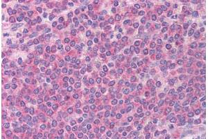Human Spleen (formalin-fixed, paraffin-embedded) stained with BCL2L11 antibody ABIN213909 at 5 ug/ml followed by biotinylated goat anti-rabbit IgG secondary antibody ABIN481713, alkaline phosphatase-streptavidin and chromogen. (BIM 抗体  (Internal Region))