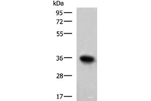 Western blot analysis of Mouse skeletal muscle tissue lysate using TNNT1 Polyclonal Antibody at dilution of 1:550 (TNNT1 抗体)