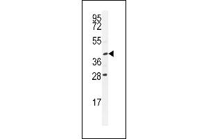 USP50 Antibody (Center) (ABIN655200 and ABIN2844815) western blot analysis in Y79 cell line lysates (35 μg/lane). (USP50 抗体  (AA 141-169))