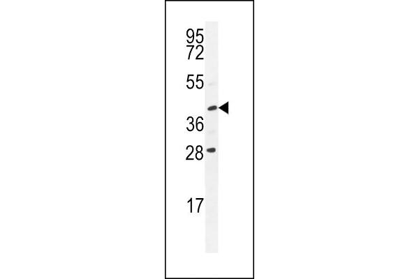 USP50 Antikörper  (AA 141-169)