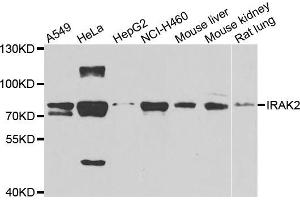 Western blot analysis of extracts of various cell lines, using IRAK2 antibody (ABIN5975418) at 1/1000 dilution. (IRAK2 抗体)