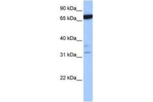 Western Blotting (WB) image for anti-Zinc Finger Protein 340 (ZNF340) antibody (ABIN2463360)