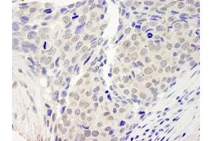 anti-Zinc Finger Protein 592 (ZNF592) (AA 950-1000) antibody