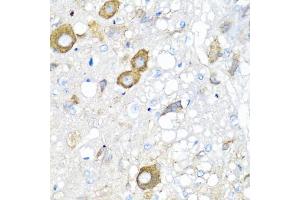 Immunohistochemistry of paraffin-embedded rat brain using MGP antibody (ABIN5975376) at dilution of 1/100 (40x lens). (MGP 抗体)