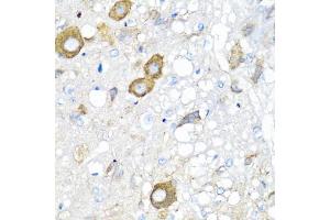 Immunohistochemistry of paraffin-embedded rat brain using MGP antibody (ABIN5975376) at dilution of 1/100 (40x lens). (MGP 抗体)