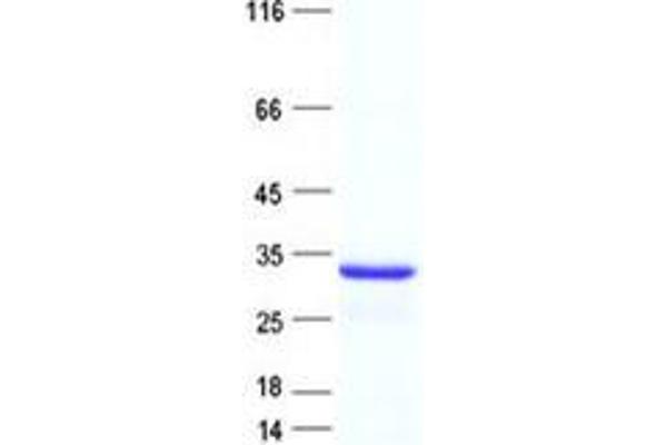 RBFA Protein (His tag)